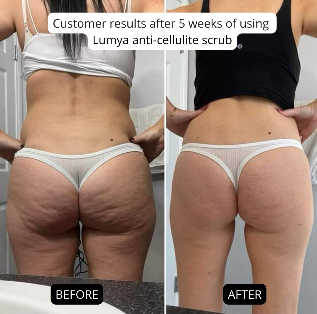 Anti-cellulite salt scrub