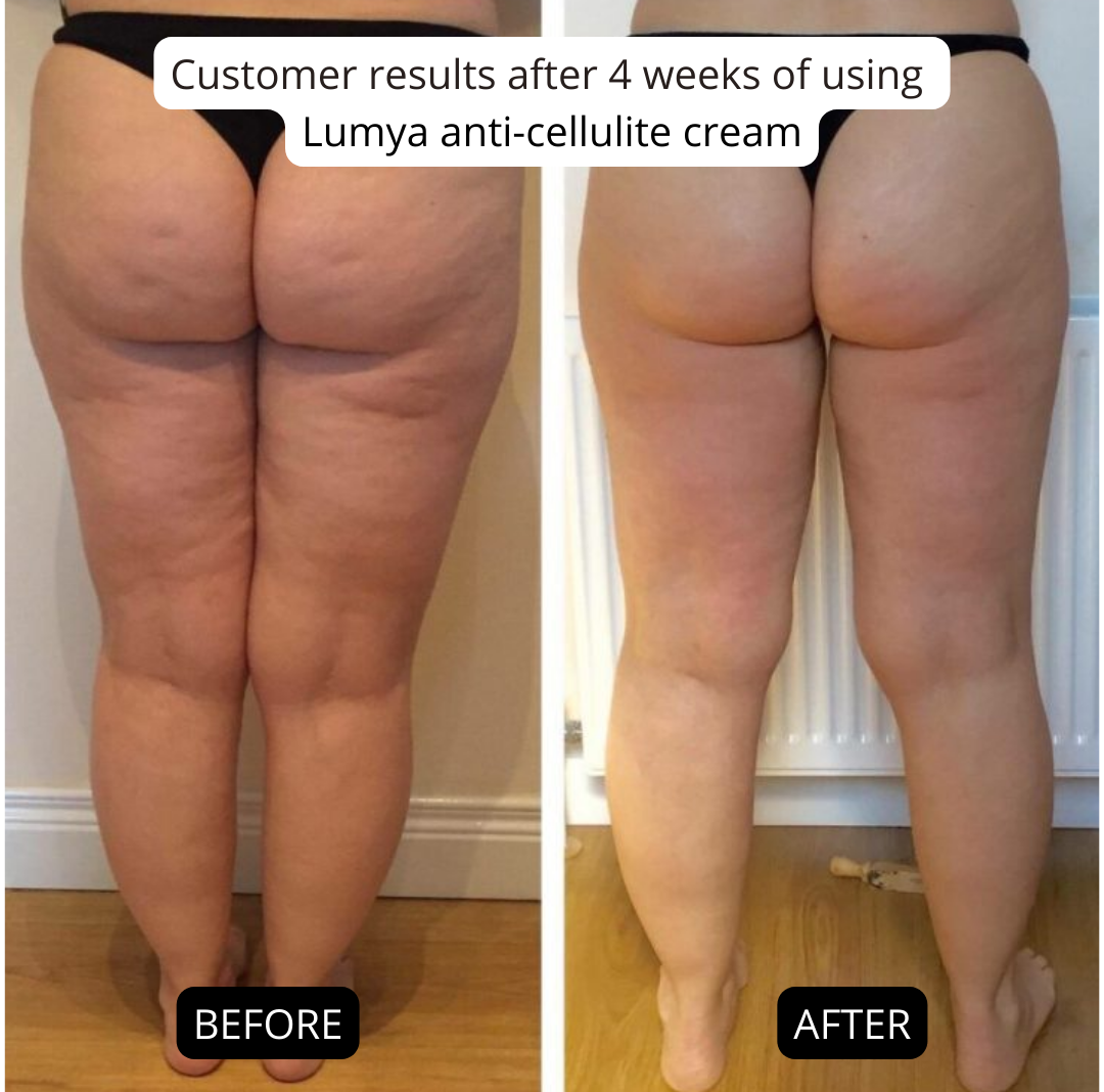 Anti-Cellulite-Creme Lumya