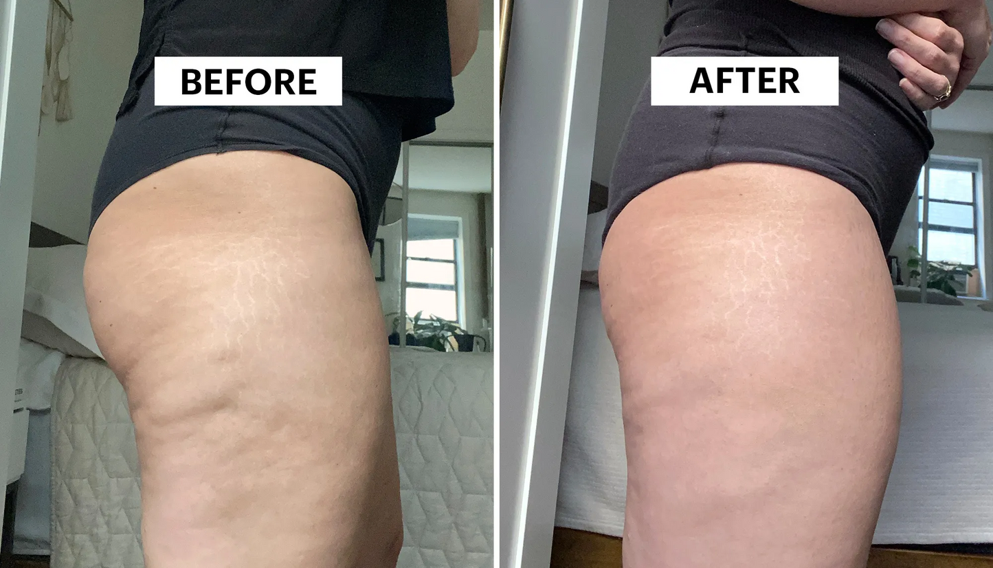 Anti-Cellulite Cream
