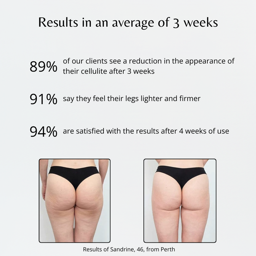 Anti-Cellulite 3D Leggings